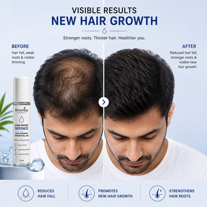 Hair Growth Serum Roll-On | Redensyl, Capixyl & Procapil | Controls Hair Fall & Supports Visible New Hair Growth